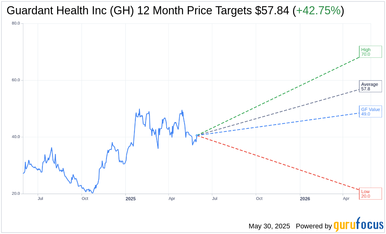 Guardant Health Inc (GH) Stock Price Up 5.11% on May 30